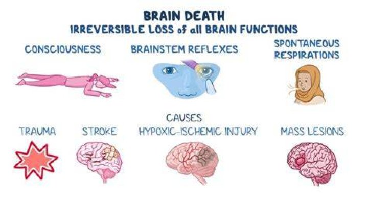 Do brain dead patients decompose?
