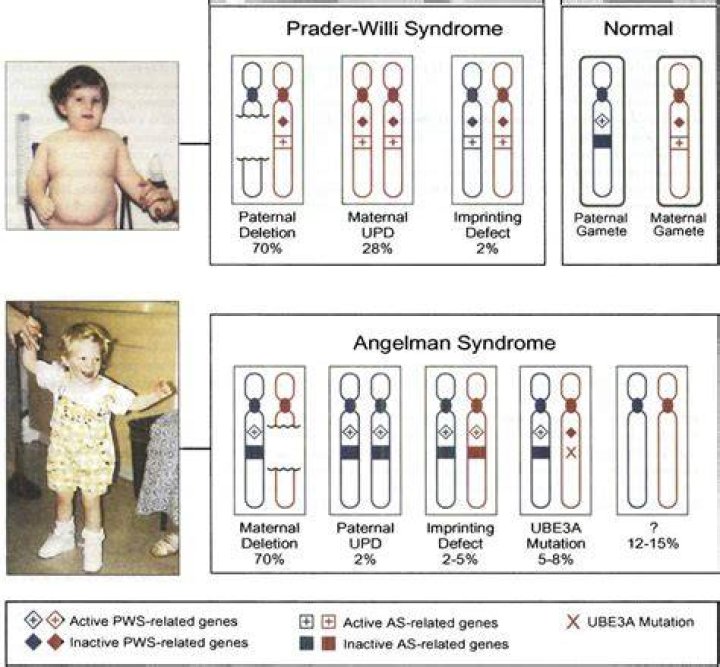 Does microarray test for Prader-Willi?