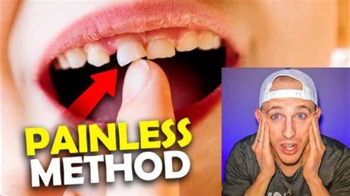 How can I loosen my tooth fast?
