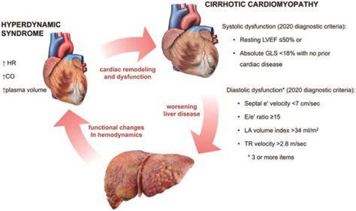 How does cirrhosis affect the heart?