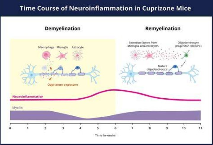 How does Cuprizone cause demyelination?