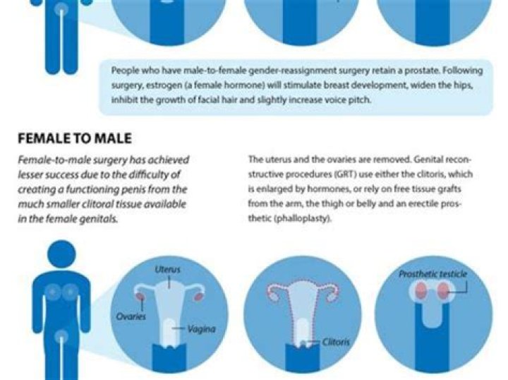 How much does it cost to turn from male-to-female?