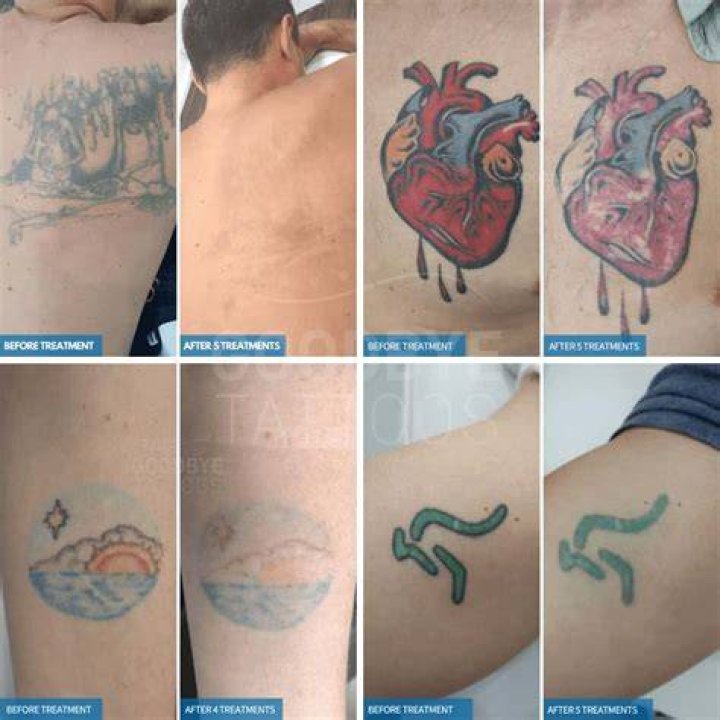 Is it bad to get color tattoo?