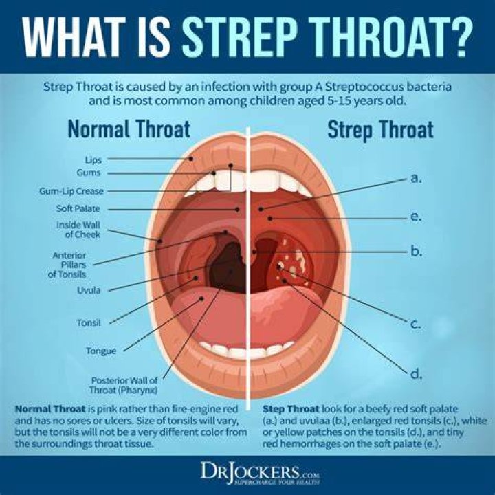 Is strep c serious?