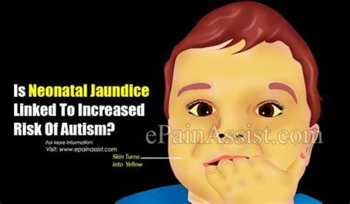 Is there a link between jaundice and autism?