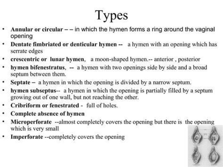 What causes a tight Hymenal ring?