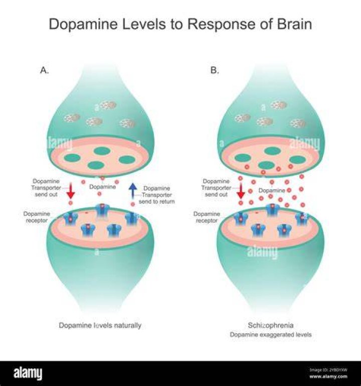 What causes high levels of dopamine in the brain?