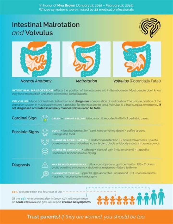What causes malrotation of the intestines?
