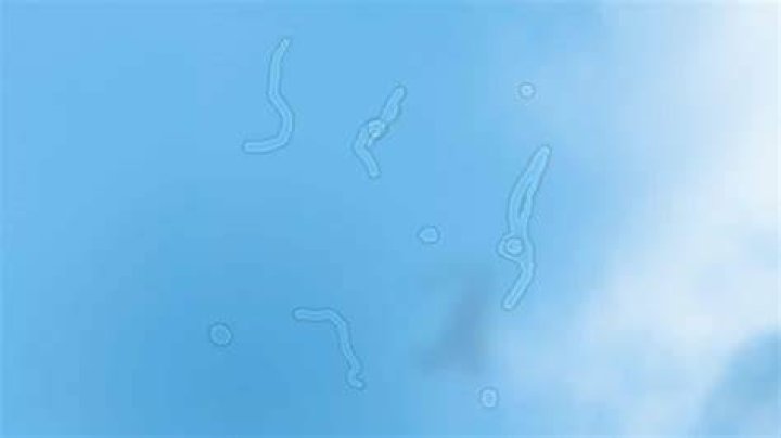What causes Myodesopsia?