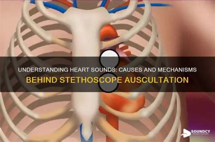 What causes the heart sounds heard with a stethoscope?