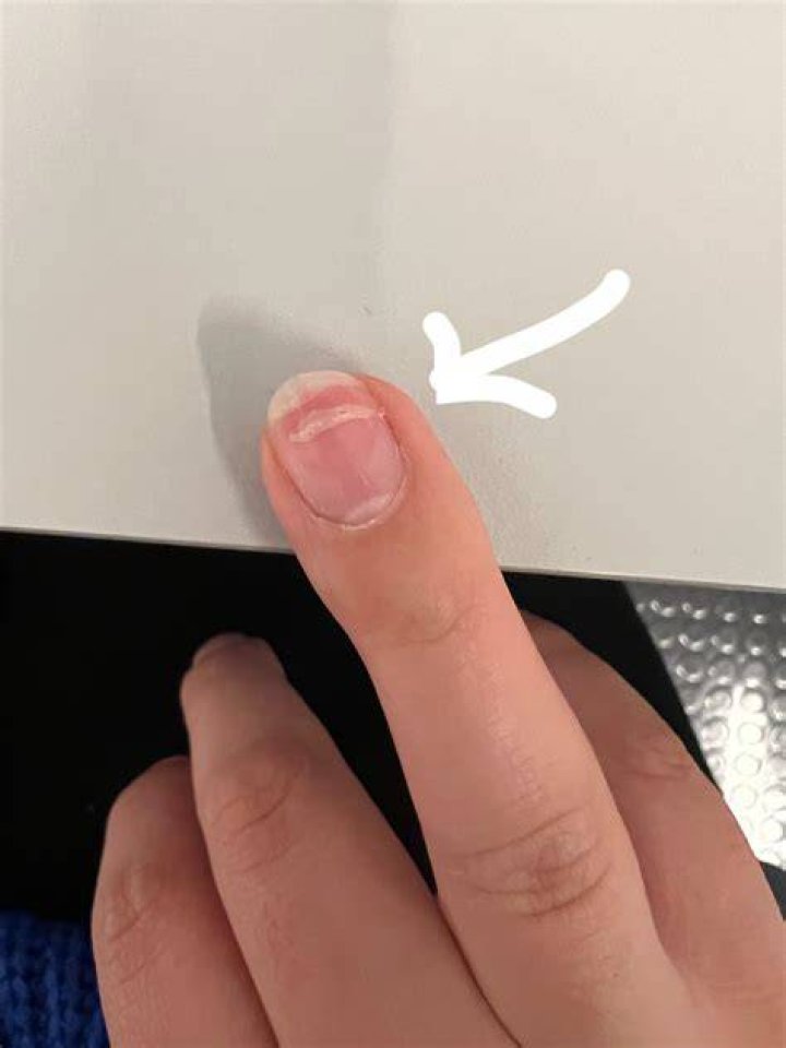 What do you do if you bend your nail backwards?
