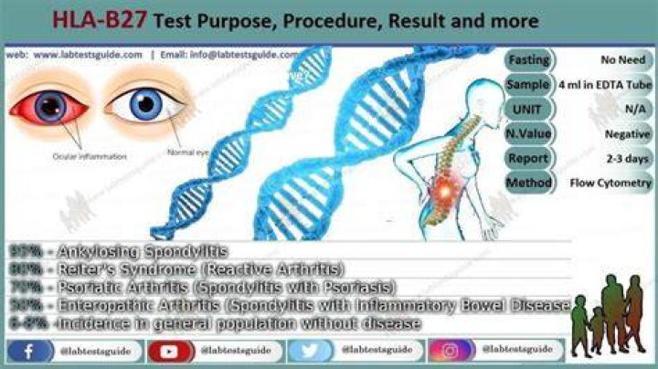 What does it mean if you test positive for HLA-B27?