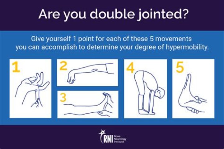 What does it mean to be double-jointed in your hands?