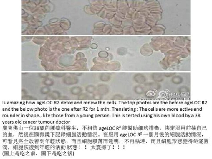 What is ageLOC R2?
