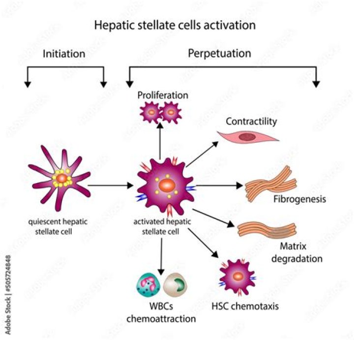 What is hepatic stellate cell activation?