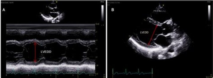 What is LVED in Echo?