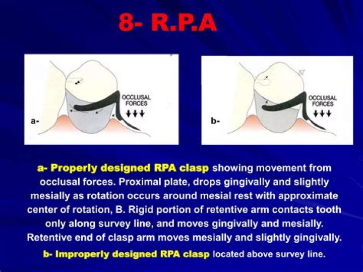 What is RPA clasp?