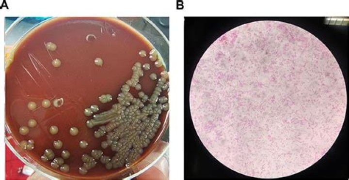 What is Stenotrophomonas infection?