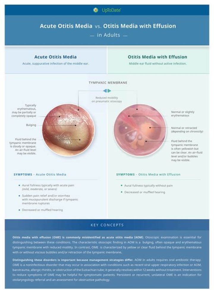 What is the first-line treatment for otitis media in adults?