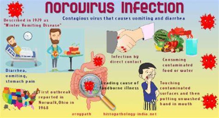 What is the main symptom of Norwalk viruses?