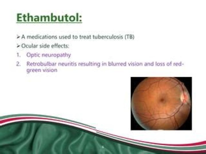 What is the most common side effect of ethambutol?