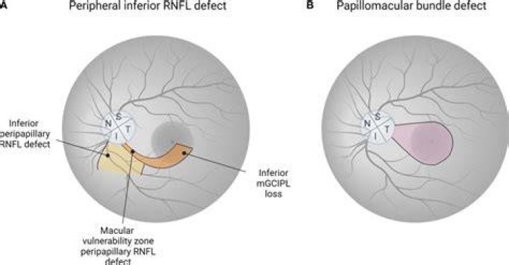 What is the Papillomacular bundle?