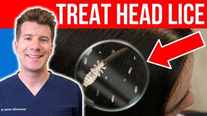 What treatment kills nits?