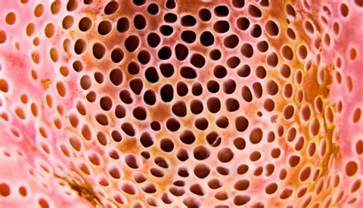 Why am I afraid of tiny holes?