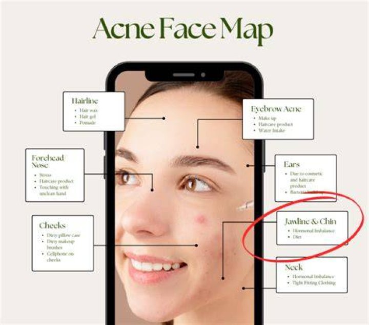 Why is my face and neck breaking out?